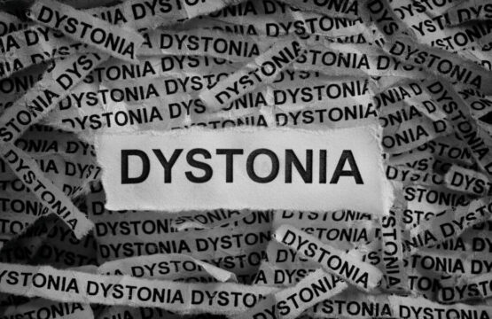 Dystonia: objawy, leczenie