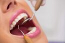 Dentysta egzamininuje zenskich cierpliwych zeby 130x86