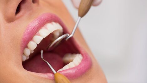 Dentysta egzamininuje zenskich cierpliwych zeby 470x264