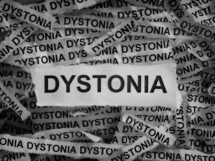 Dystonia M 1 215x161