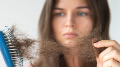 Foto Main Artykul Dlaczego wlosy wypadaja wlasnie wiosna 470x264