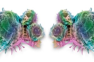 Foto Main Artykul Limfocyty odwracaja procesy starzenia 300x200