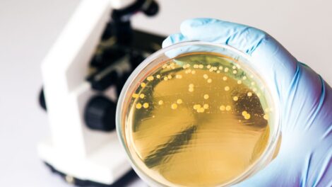 Jelita badania news 470x264