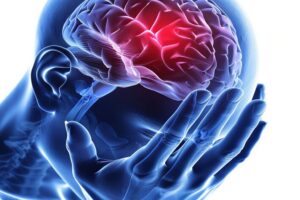 Nerw bedny 2 Kopiowanie 300x200