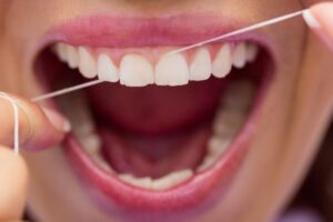 Nitkowanie 2 300x200