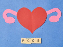 PCOS a zdrowie psychiczne 215x161