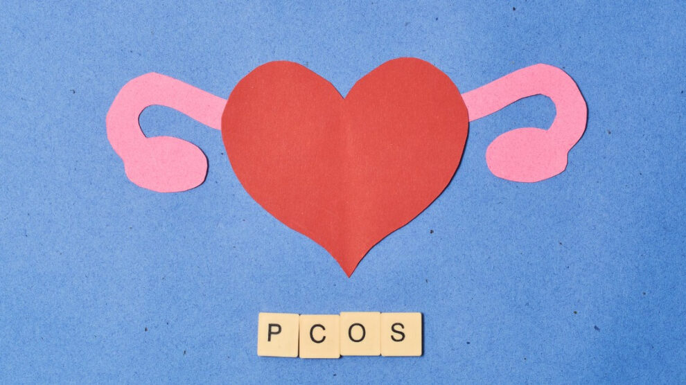 PCOS a zdrowie psychiczne 990x556