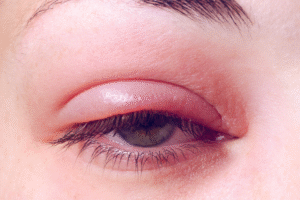 Projekt bez nazwy 2023 08 22T123511 900 300x200