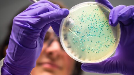 Analiza mikrobiomu jelitowego 1 470x264