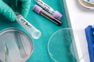 Choroby autimmunologiczne 1 300x200