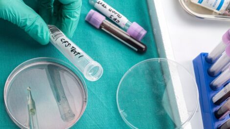 Choroby autimmunologiczne 1 470x264