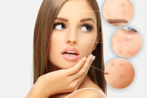 Fot  materialy prasowe 1 300x200