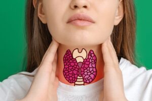 Holistyczna opieka nad tarczyca M 300x200