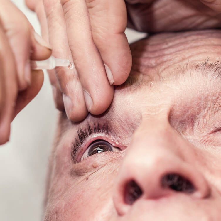 krople do oczu – zaćma krople do oczu - zaćma