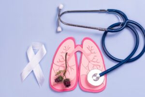 Miesiac swiadomosci raka pluca 300x200