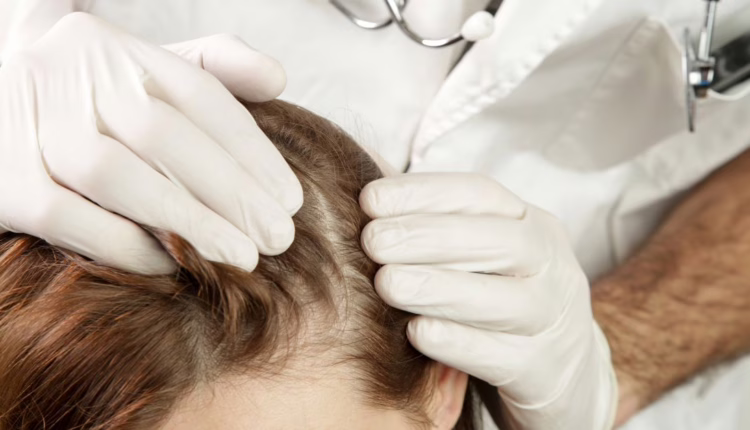 • naturalne sposoby na odbudowę mikrobiomu skóry