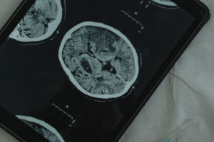 Nie ma zdrowia bez mozgu 300x200