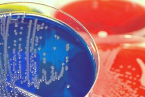 Problemy z mikrobiomem u dzieci 1 300x200