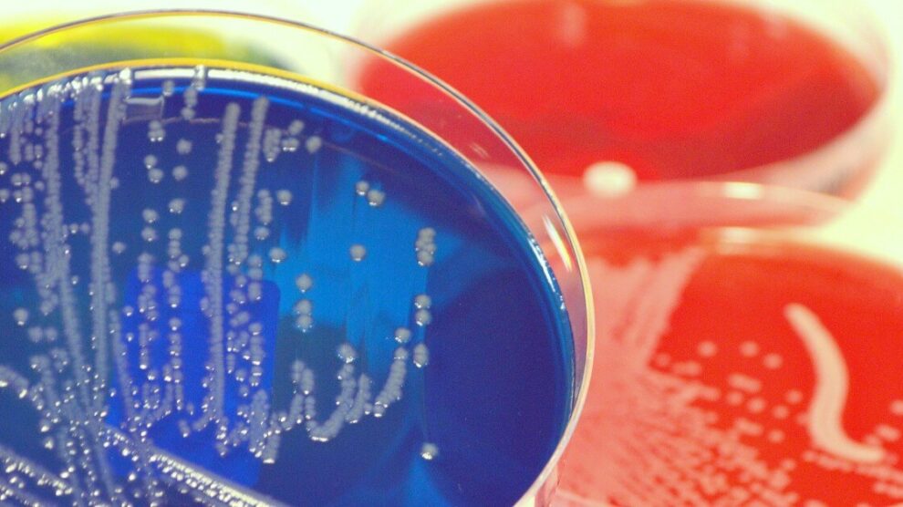 Problemy z mikrobiomem u dzieci 1 990x556