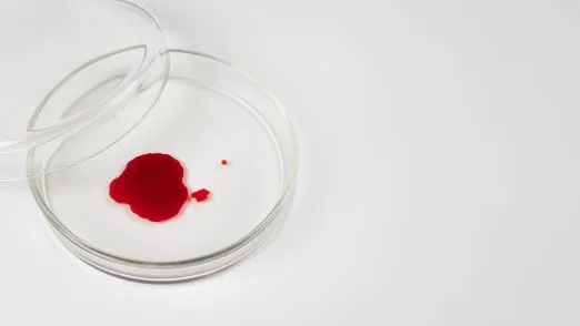 Widok probek z probowek laboratoryjnych jpg