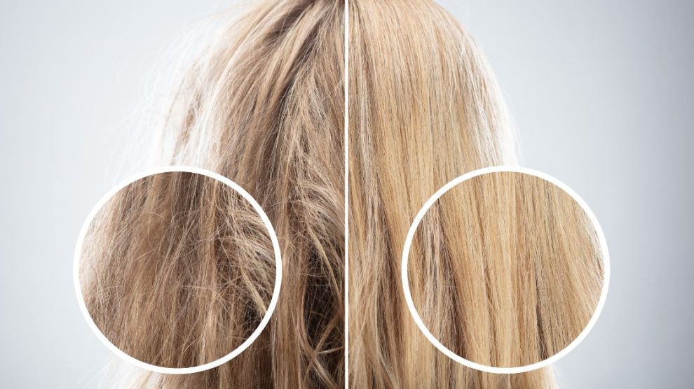 przetłuszczanie się włosów - naturalne sposoby