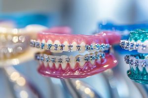 nowe możliwości w leczeniu ortodontycznym