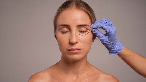 Blefaroplastyka 470x264