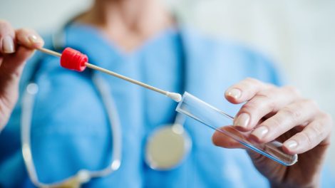 streptococcus i układ krążenia