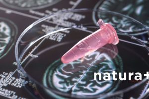 jaki wpływ na pracę szyszynki ma środowisko