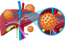 HCV 1 130x86