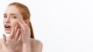 Young caucsian woman squeezes acne face beauty 300x168