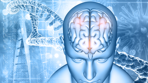 choroby neurologiczne Huntington