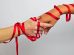 HIV w Polsce – 35 tys  zakazen i skuteczne leczenie 74x55