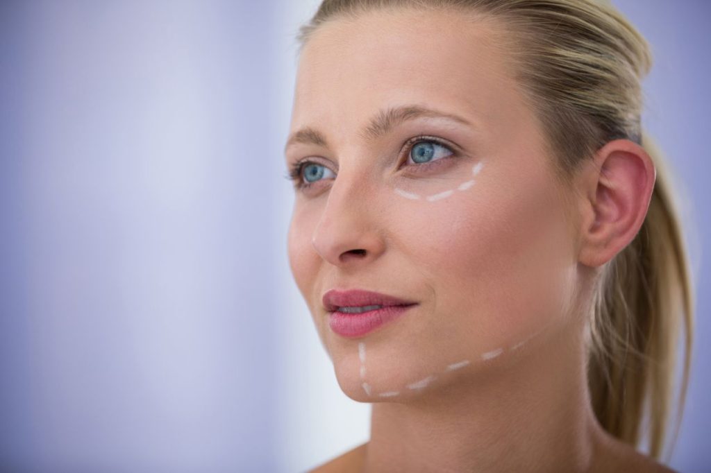 Woman with marks drawn cosmetic treatment 1024x682