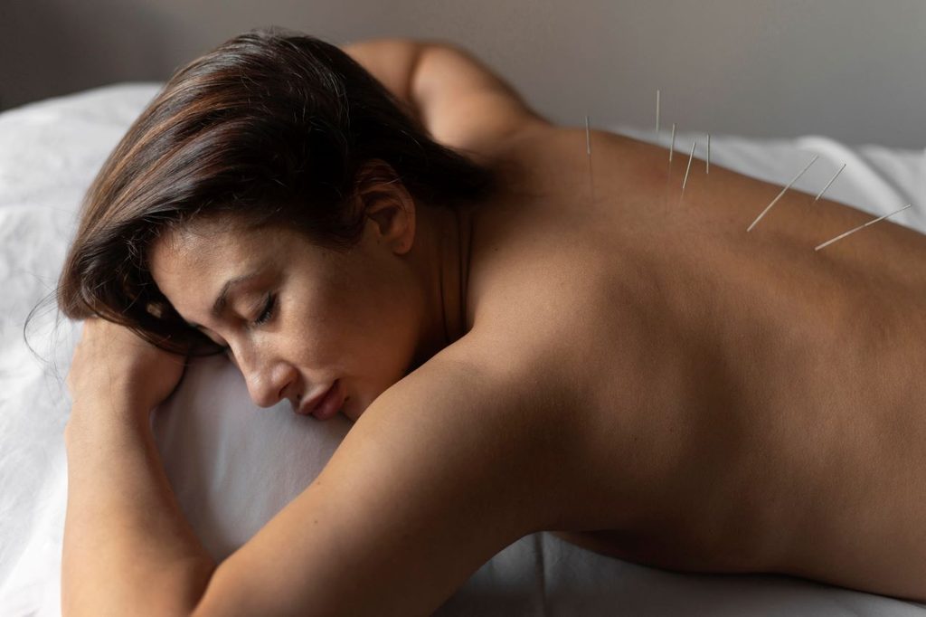 Medium shot woman acupuncture 1024x682